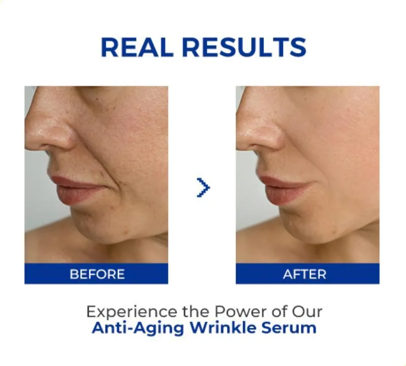 🎉50% OFF🎉Anti-Aging Wrinkle Serum