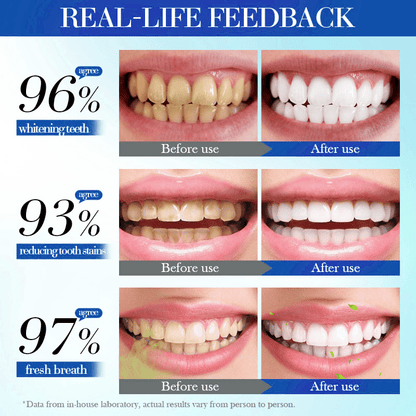 💥Hot Listing 🔥Alisanda Hydroxyapatite Toothpaste 7.5%