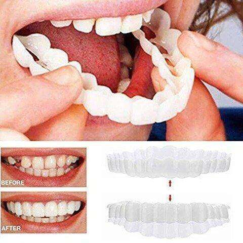 (😍Summer sale - 🔥50% off) Snap On Smile Veneers 😁 recommended by German doctor dentist👨‍⚕.