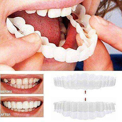 (😍Summer sale - 🔥50% off) Snap On Smile Veneers 😁 recommended by German doctor dentist👨‍⚕.