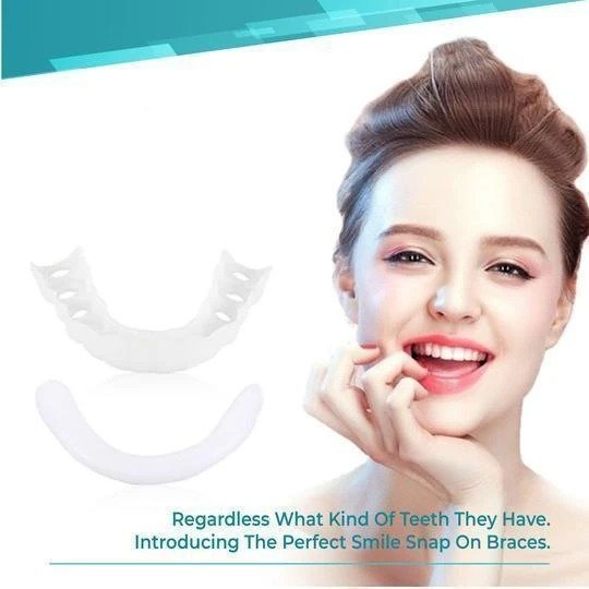 🎉50% OFF🎉 SMILE SNAP-ON BRACES
