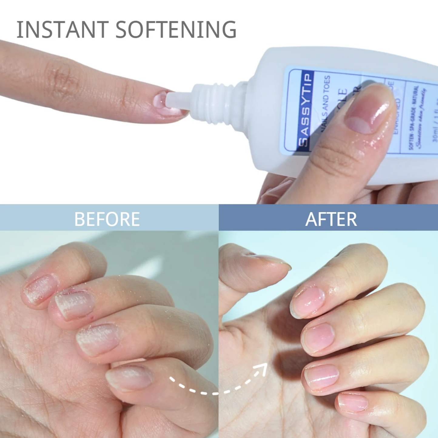 🔥BUY 2 GET 1  FREE - Cuticle Remover Cream