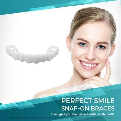 🎉50% OFF🎉 SMILE SNAP-ON BRACES