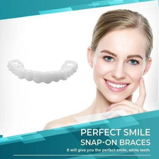 🎉50% OFF🎉 SMILE SNAP-ON BRACES