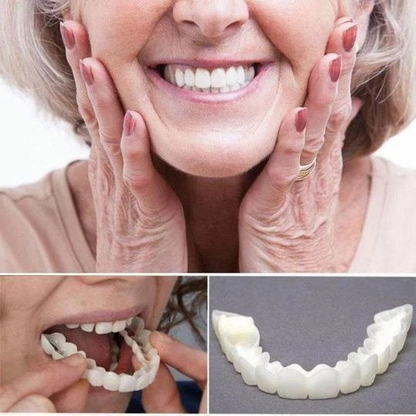 🎉50% OFF🎉 SMILE SNAP-ON BRACES