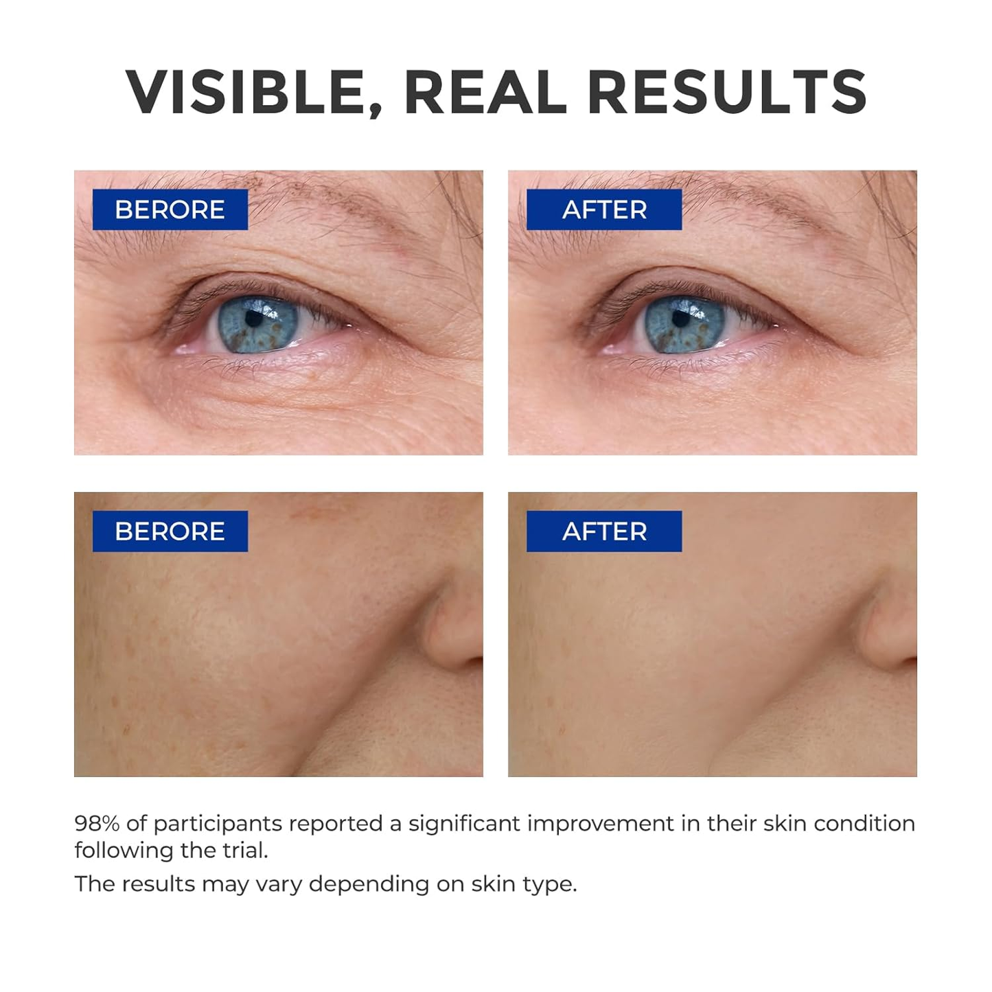 🎉50% OFF🎉Anti-Aging Wrinkle Serum