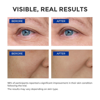 🎉50% OFF🎉Anti-Aging Wrinkle Serum