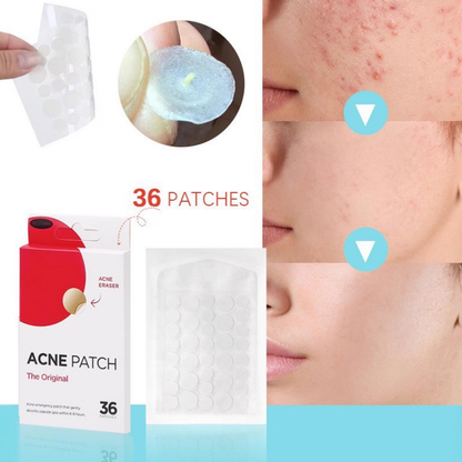 🔥BUY 1 GET 1 FREE - 72 PCS Acne Patch