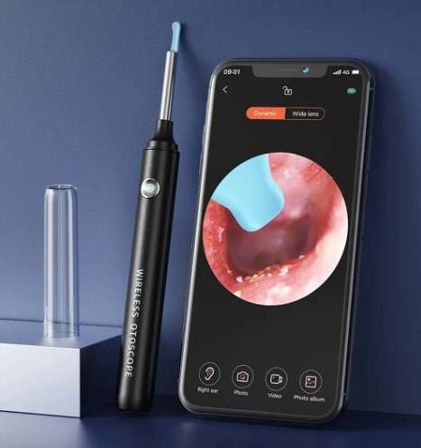 🔥HOT Sales🔥2025 EAR CLEANING WITH CAMERA