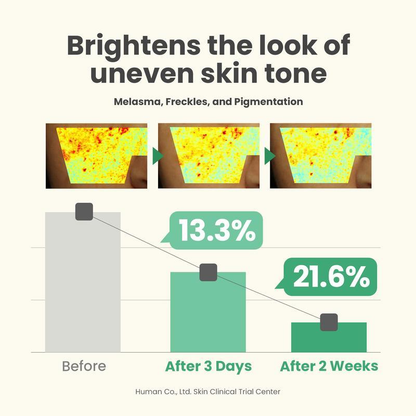 ❤️❤️BUY 2 GET 2 FREE - AXIS-Y Dark Spot Correcting Glow Serum