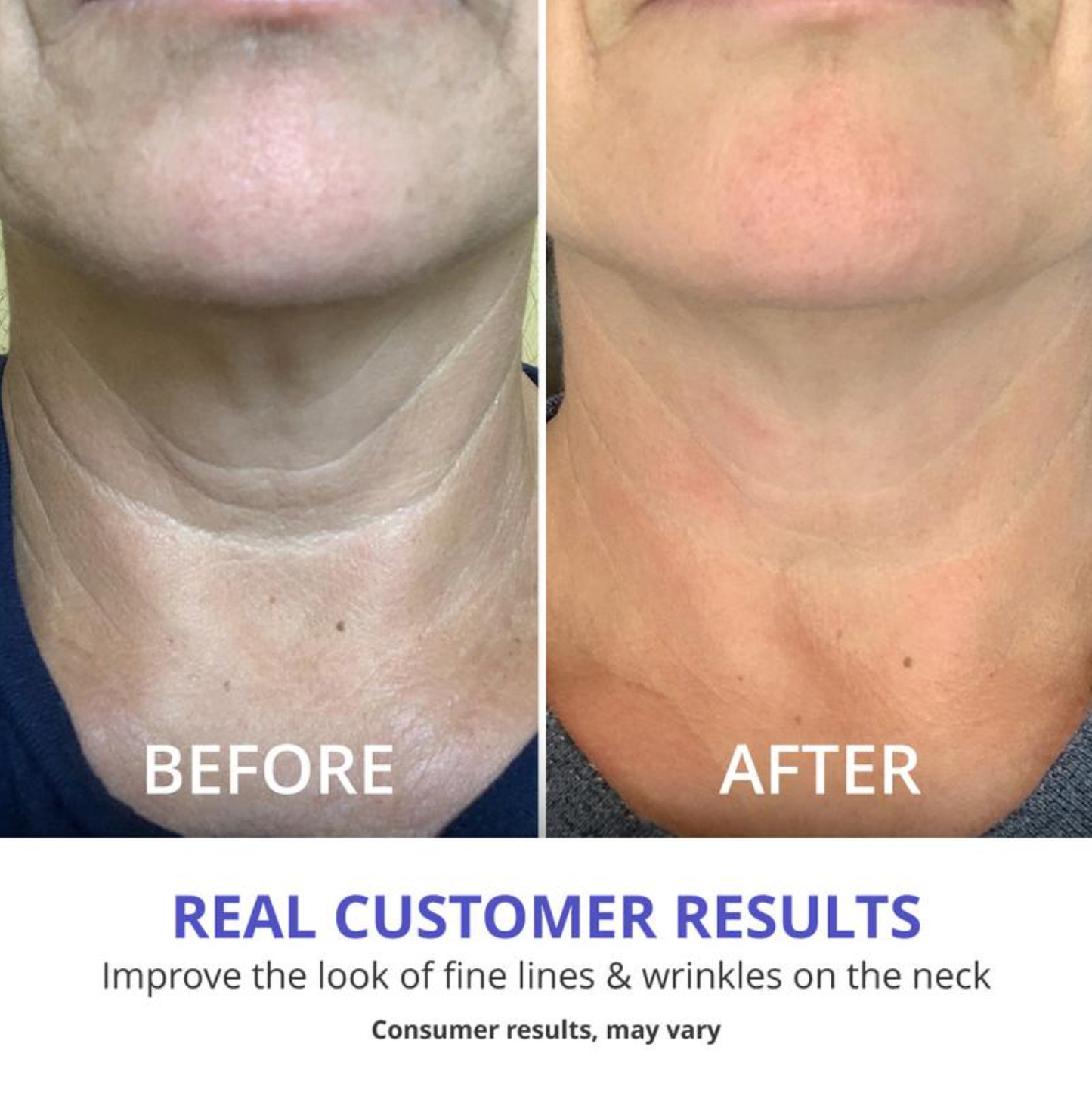 🔥BUT 1 GET 1 FREE - Neck Firming Cream