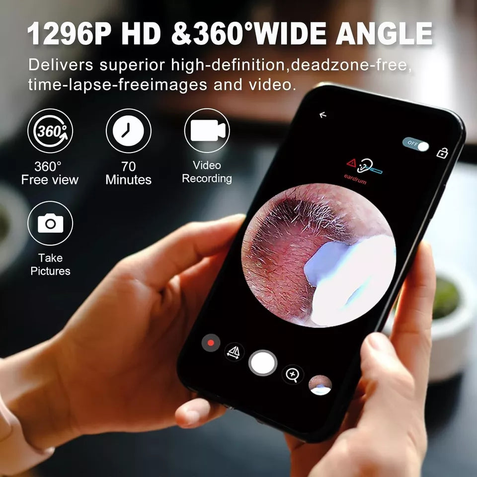 🔥HOT Sales🔥2025 EAR CLEANING WITH CAMERA