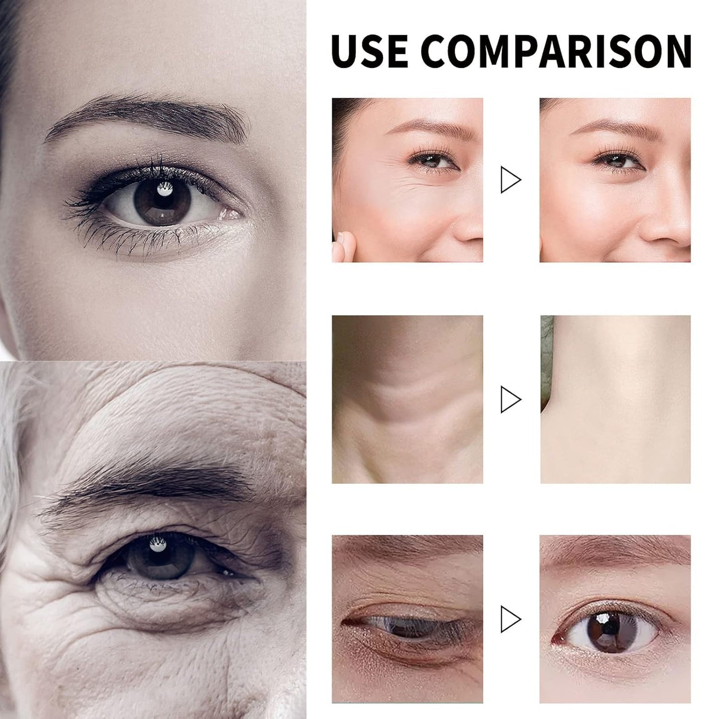 🔥HOT SALES 60% OFF🔥  Qingling Wrinkle Removal Cream