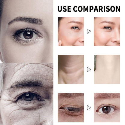 🔥HOT SALES 60% OFF🔥  Qingling Wrinkle Removal Cream