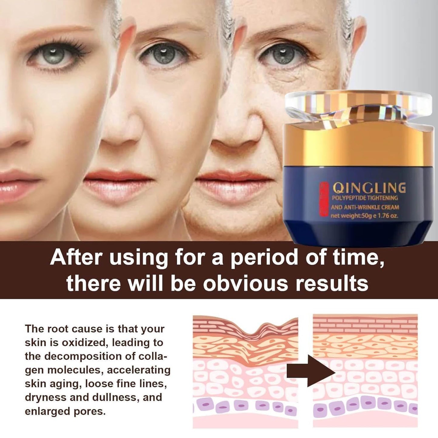 🔥HOT SALES 60% OFF🔥  Qingling Wrinkle Removal Cream