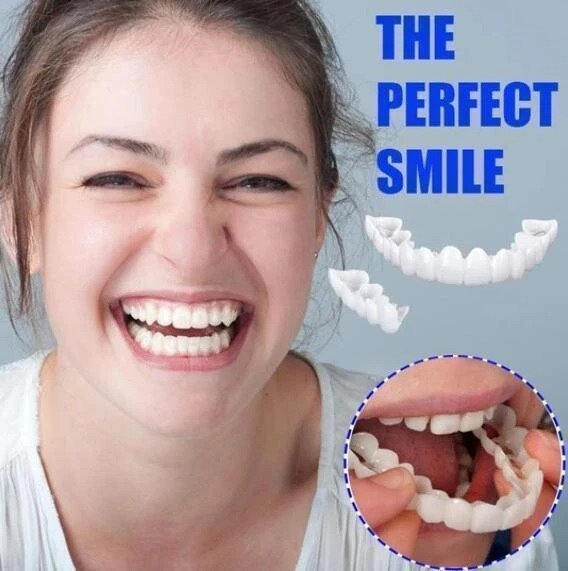 🎉50% OFF🎉 SMILE SNAP-ON BRACES