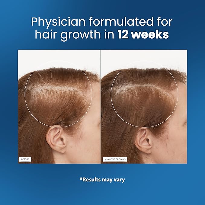 Be Bodywise™  Hair Growth Roll-On Serum