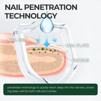 Tea Tree Ginger Nail Fungus Treatment