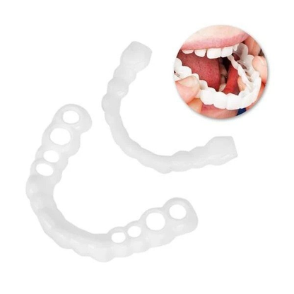 🎉50% OFF🎉 SMILE SNAP-ON BRACES