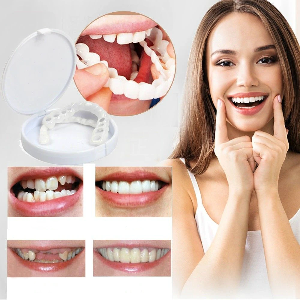 (😍Summer sale - 🔥50% off) Snap On Smile Veneers 😁 recommended by German doctor dentist👨‍⚕.