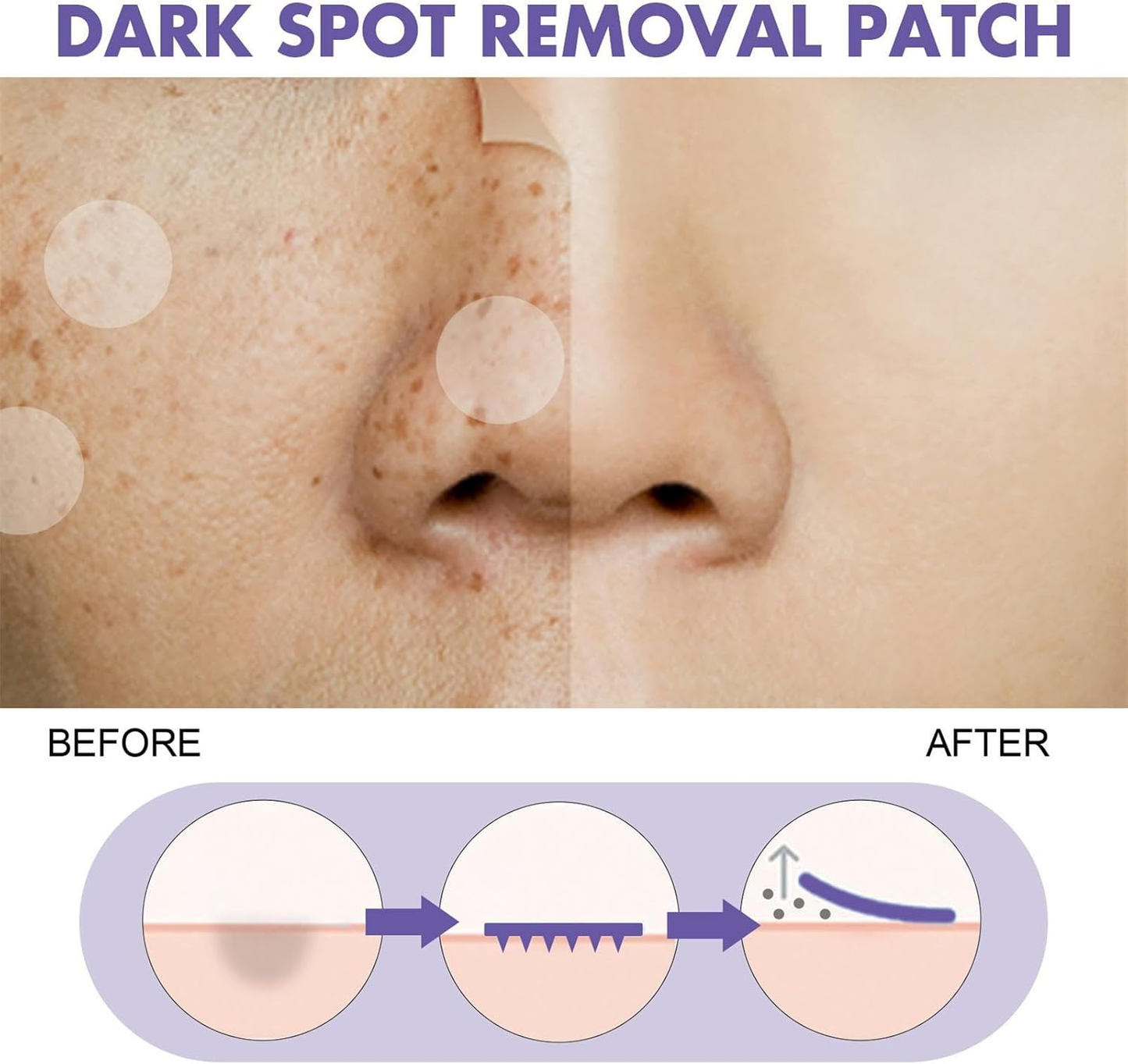 🔥Flash sales60% OFF - 144pcs Dark Spot Removal Patch