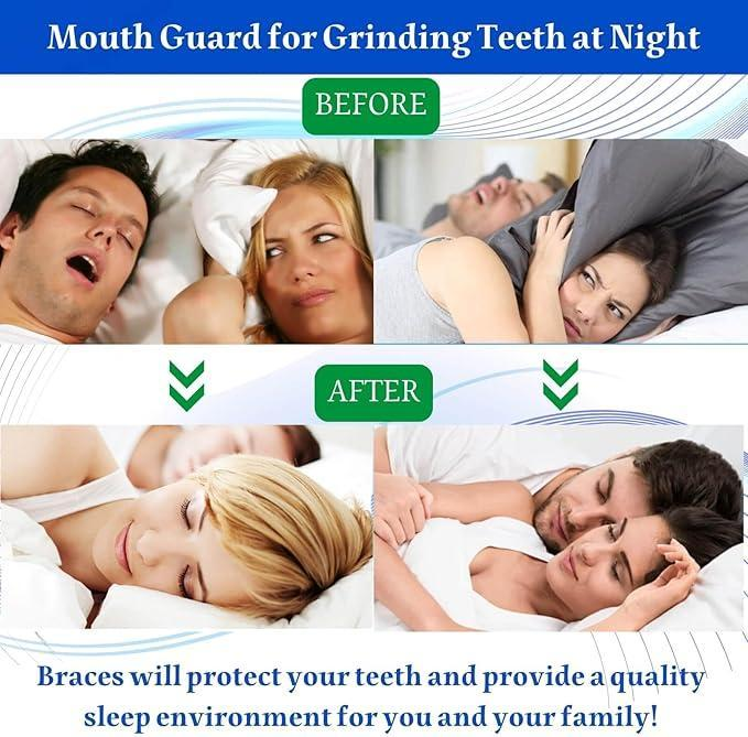 🔥BUY MORE AND SAVE MORE🔥Mouth Guard for Grinding Teeth