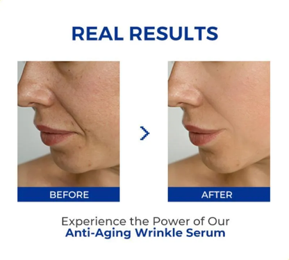🎉50% OFF🎉Anti-Aging Wrinkle Serum
