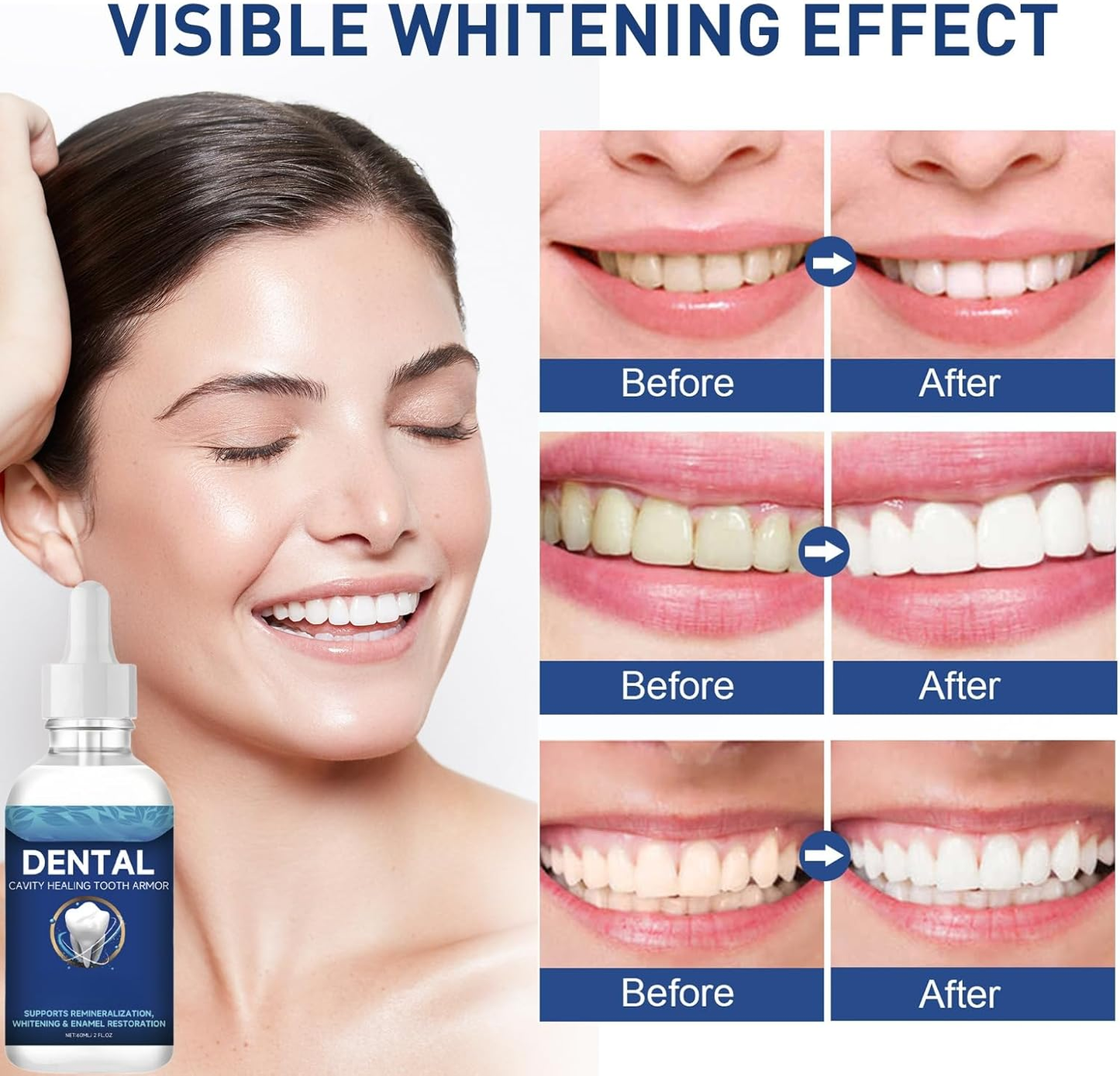 🔥BUY MORE SAVE MORE🔥Original Dentite Tooth Armor Liquid