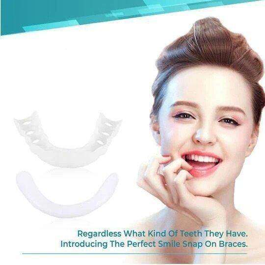 (😍Summer sale - 🔥50% off) Snap On Smile Veneers 😁 recommended by German doctor dentist👨‍⚕.