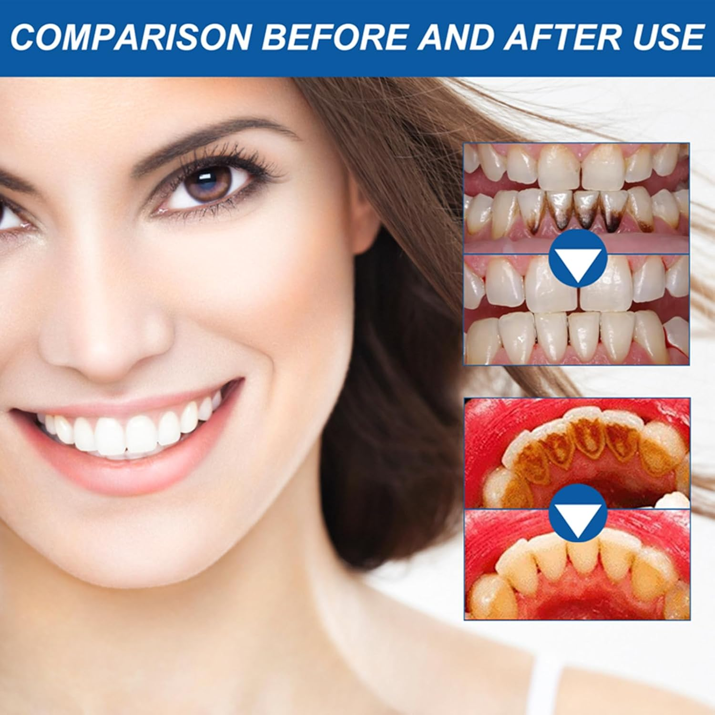 🎉50% OFF - Teeth Whitening Essence