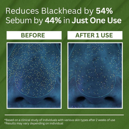 🔥BUY MORE SAVE MORE🔥Holy Basil Bubble Deep Mask