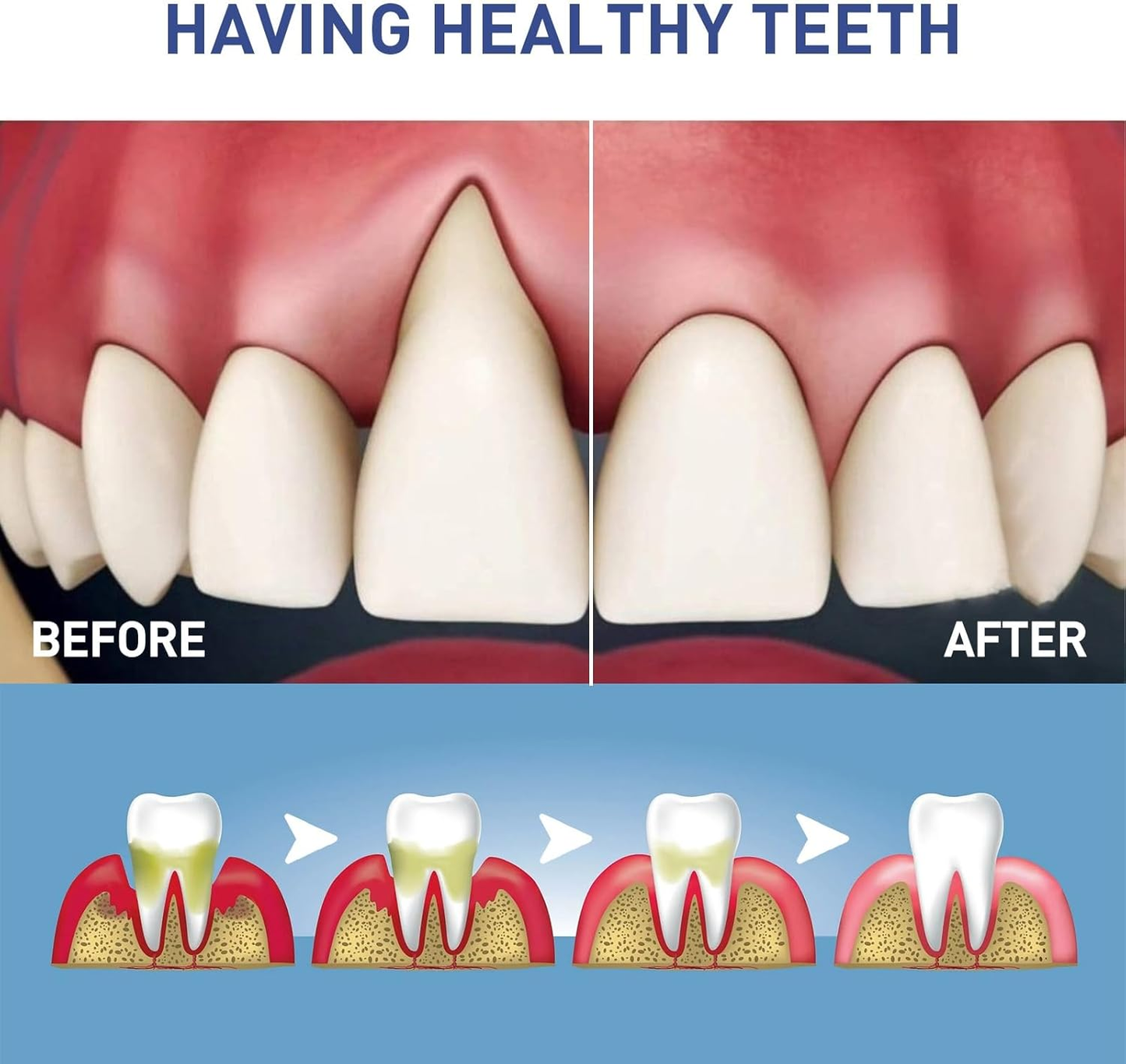 🔥BUY MORE SAVE MORE🔥Original Dentite Tooth Armor Liquid