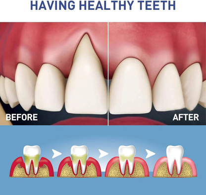 🔥BUY MORE SAVE MORE🔥Original Dentite Tooth Armor Liquid