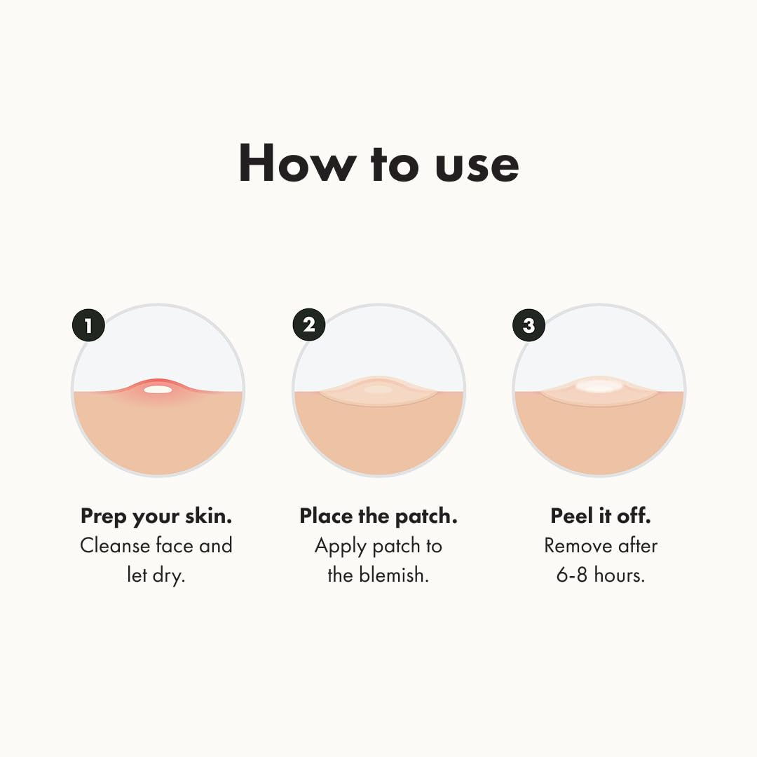 🔥BUY 1 GET 1 FREE - 72 PCS Acne Patch