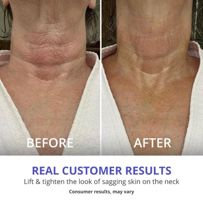 🔥BUT 1 GET 1 FREE - Neck Firming Cream