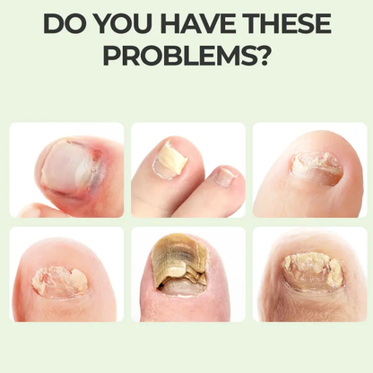 Tea Tree Ginger Nail Fungus Treatment