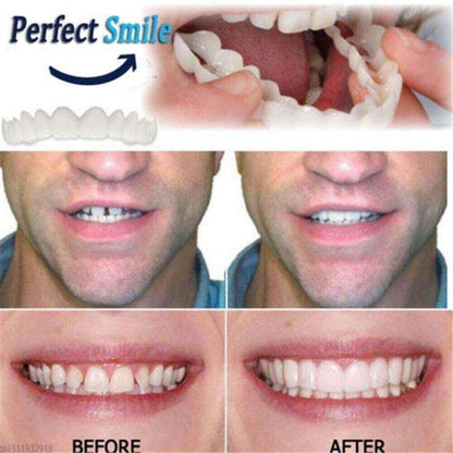(😍Summer sale - 🔥50% off) Snap On Smile Veneers 😁 recommended by German doctor dentist👨‍⚕.