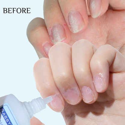 🔥BUY 2 GET 1  FREE - Cuticle Remover Cream